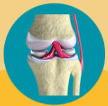 Consolidação Óssea